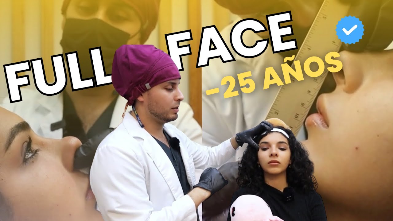 Full Face con Ácido Hialurónico en Ojeras, Mentón, Surco Nasogeniano y Nariz| Resultado Natural ✨