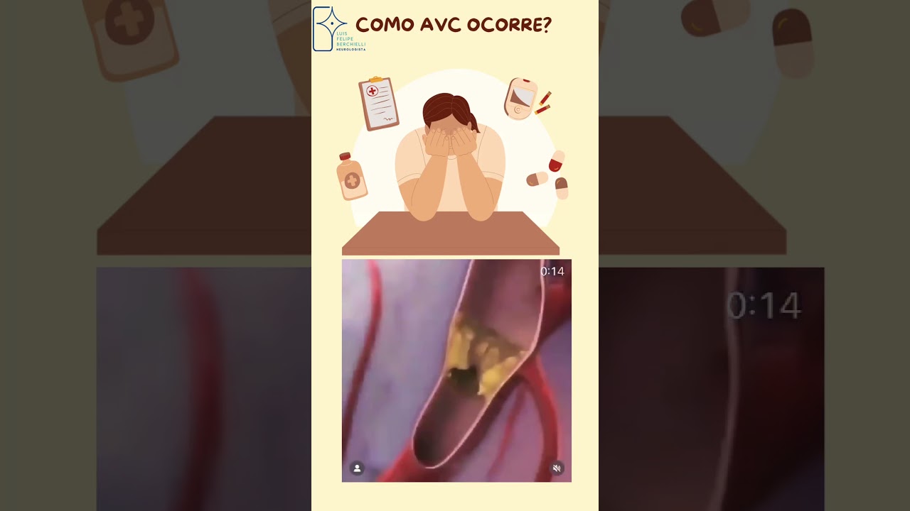 ACIDENTE VASCULAR CEREBRAL: ENTENDA COMO OCORRE O AVC