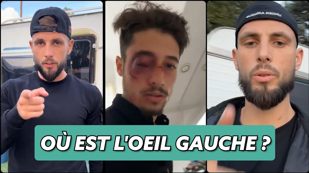 affaire Capi et Niglo c'est une mise en sc&egrave;ne de Capi ?