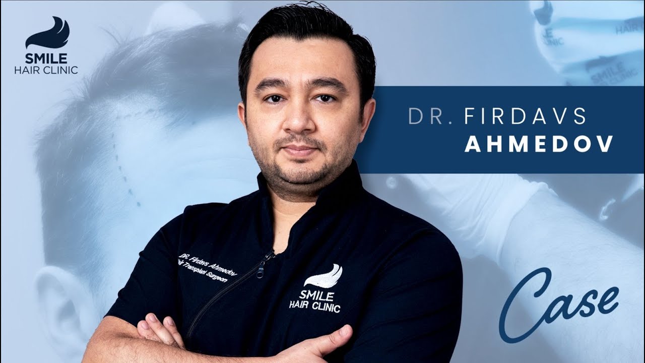 Case Studies with Dr. Firdavs Ahmedov | 3800 Grafts & 12 Month Results