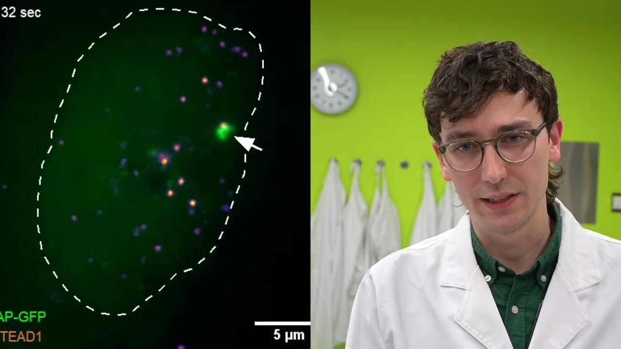 Peter Mac researchers capture DNA-binding proteins on film for the first time