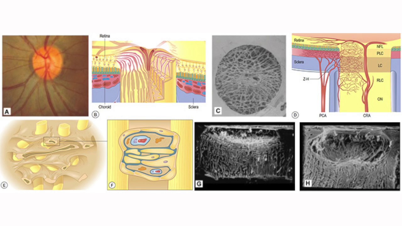 Optic Nerve Head Biomechanics