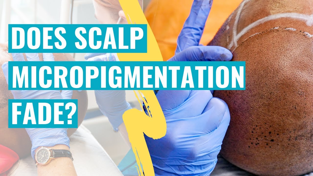 Does Scalp Micropigmentation Fade? An SMP Practitioner Explains