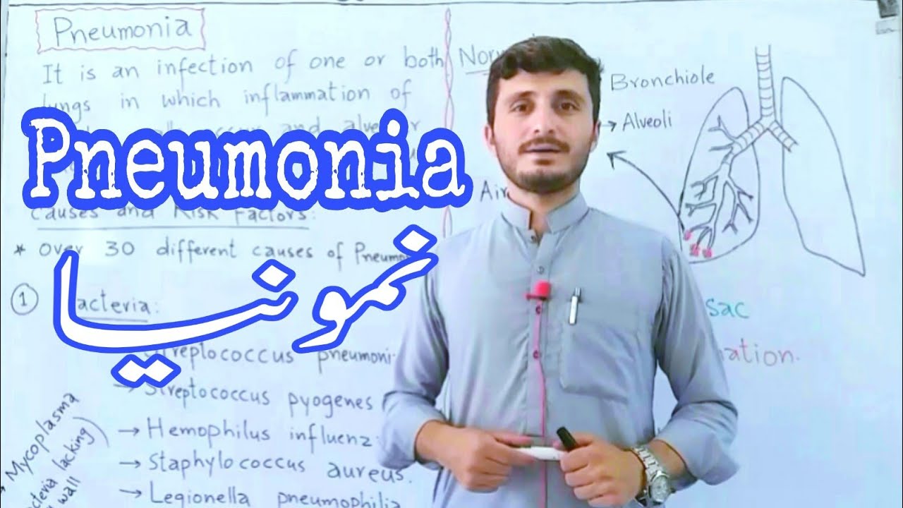 Pneumonia | Causes | Symptoms | Treatment | Prevention | Facts | MCQs | Kingdom of Biology