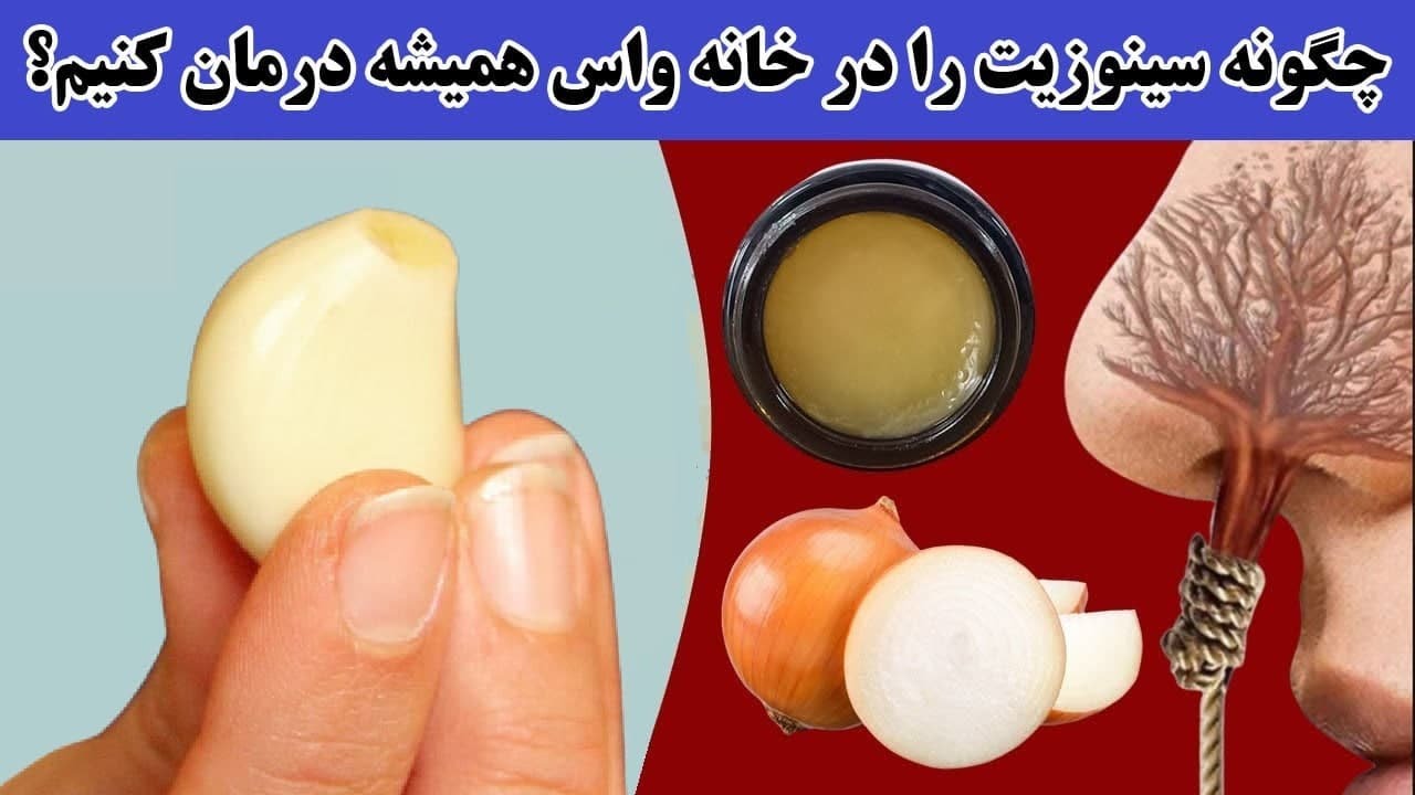 درمان سینوزیت با سیر و روش های علمی