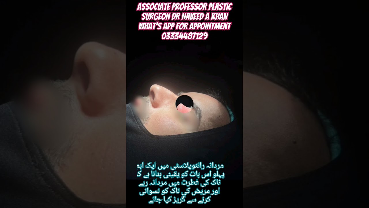 #MaleRhinoplasty#NoseSurgery#FacialSurgery#CosmeticSurgery#PlasticSurgery#MenBeauty#NoseJob