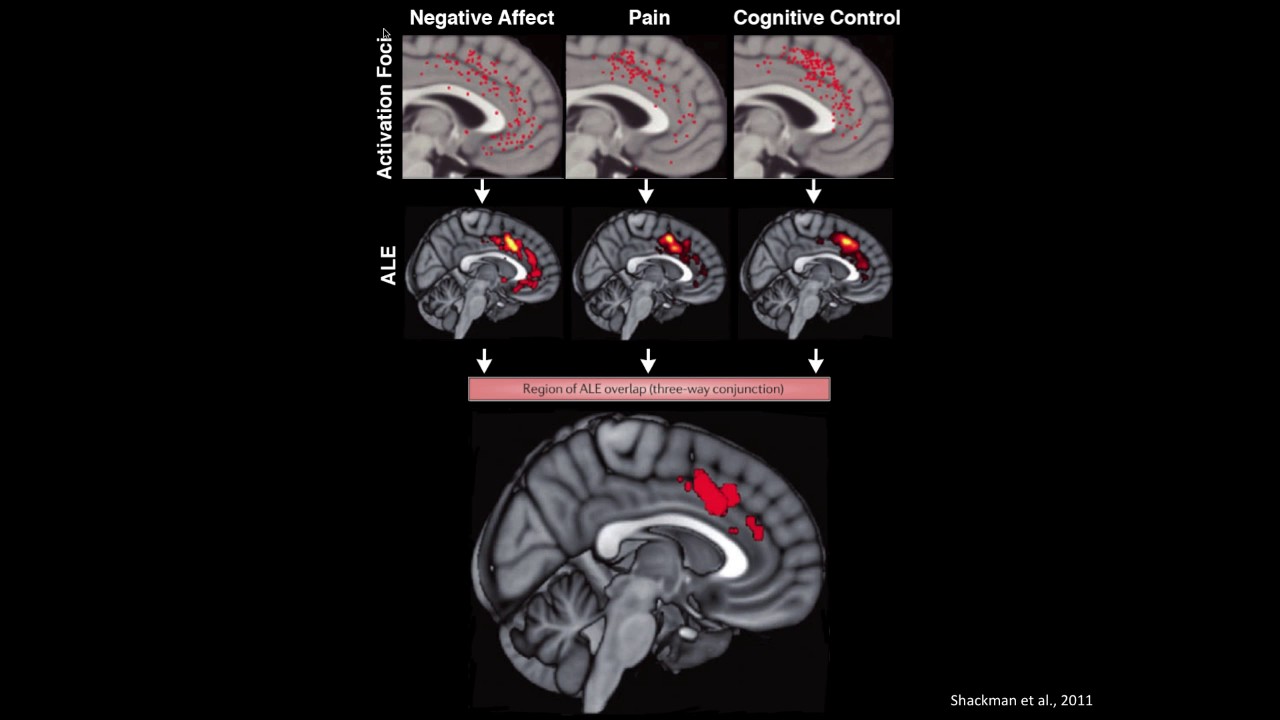 Distinct Regions of mPFC Process Pain and Cognition