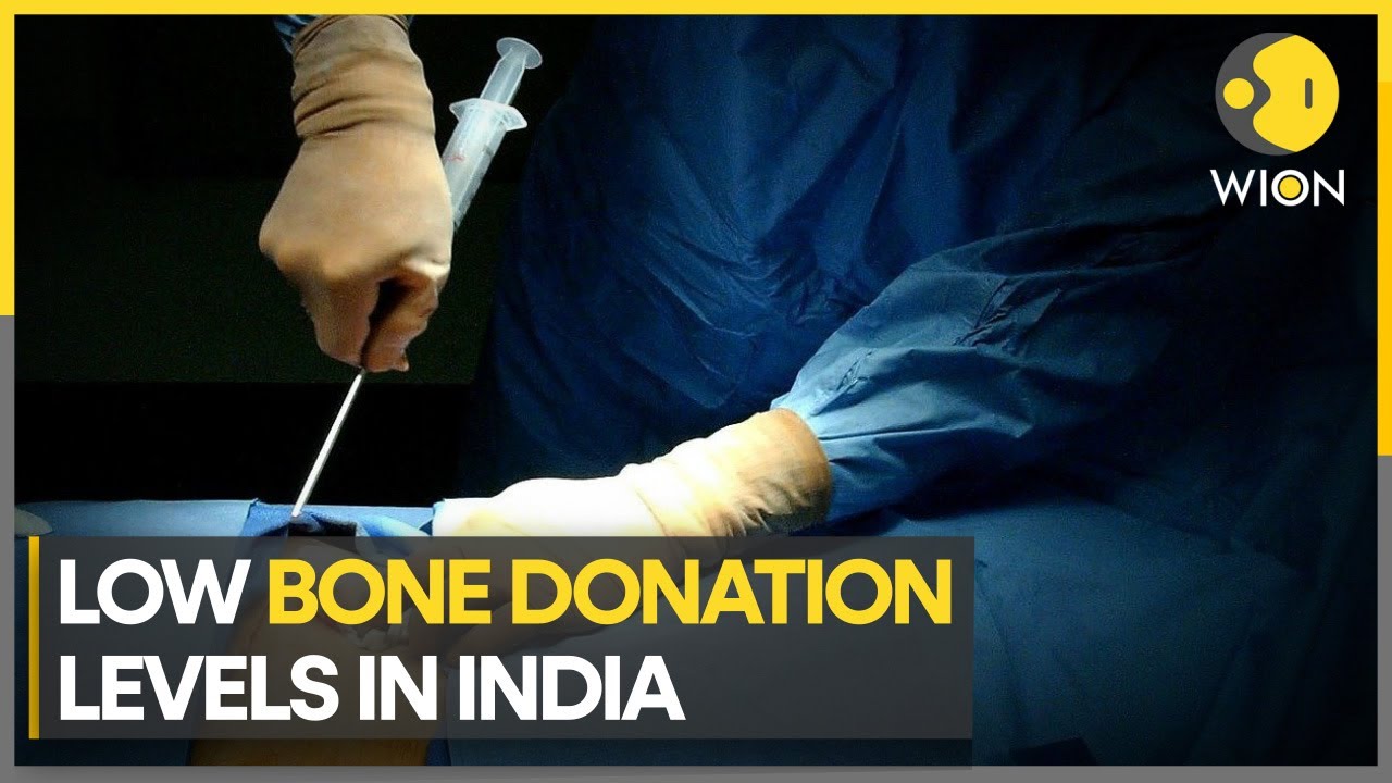 Bone Donation CRISIS in India's Financial Capital: Demand-Supply Mismatch | WION News Update