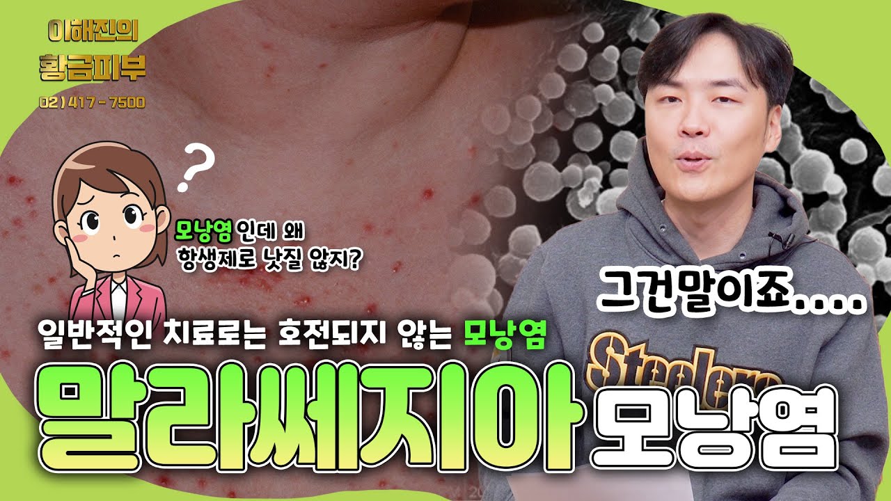 이런 모낭염이 있나... 말라쎄지아 모낭염 / 연세에이앤비 피부과 이해진원장