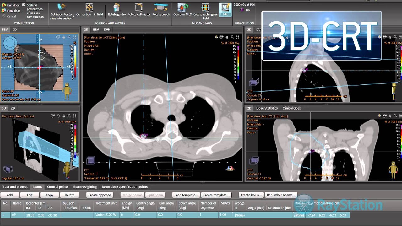 RaySearch Laboratories Introduction Video