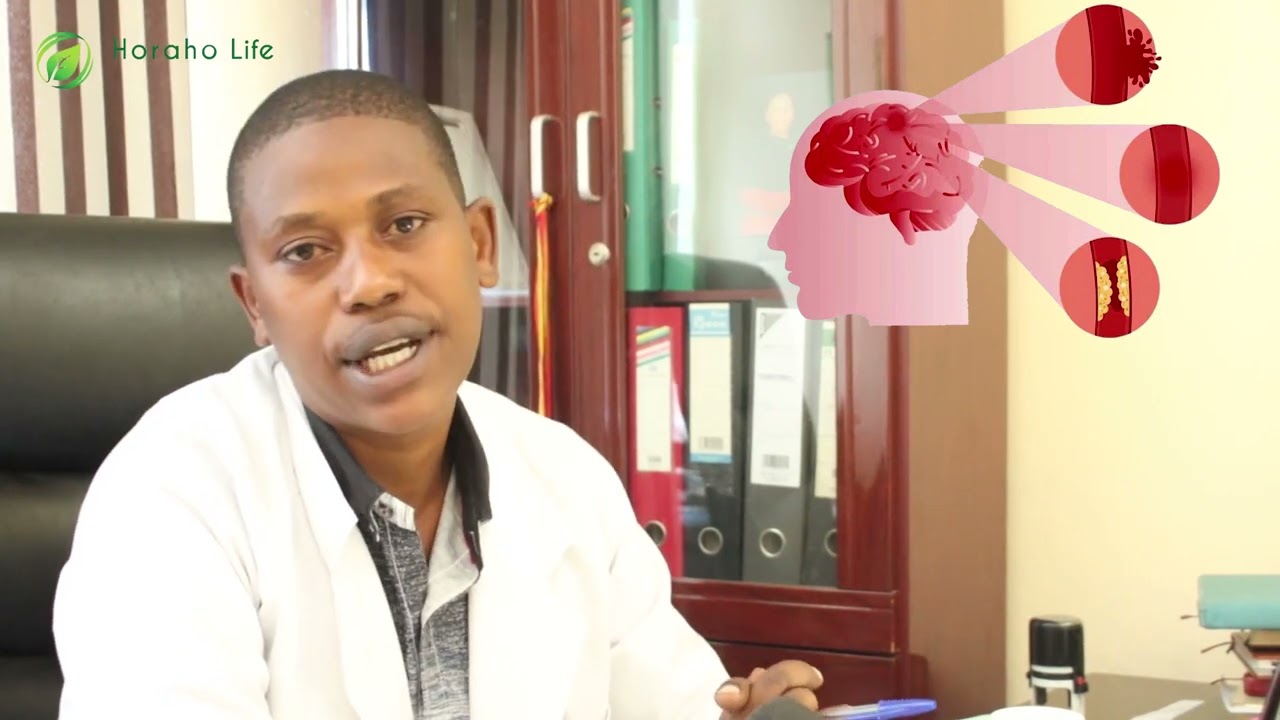 Stroke indwara ihitana abatari bake ,birashoboka kuyirinda.