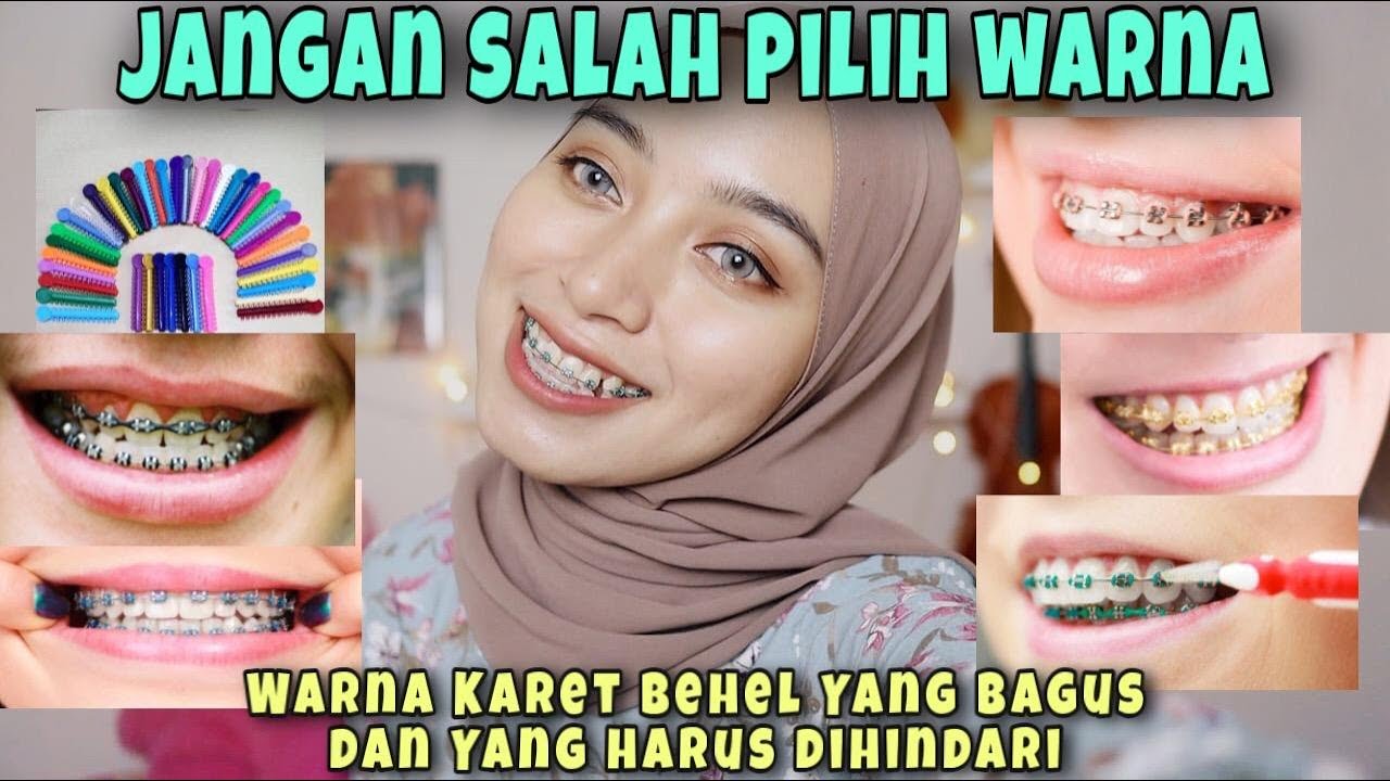 Tips & Cara Mudah Memilih Warna Karet Behel ll Wajib Tau sebelum Pasang Kawat Gigi