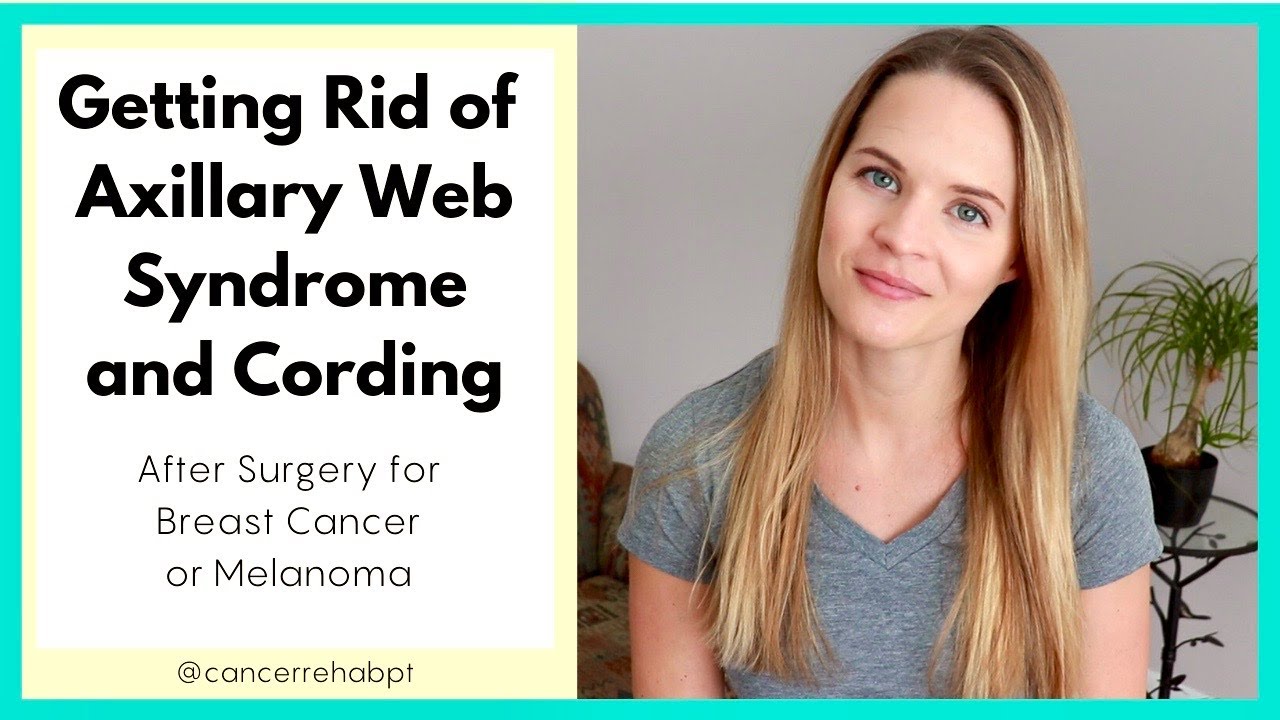 Getting Rid of Axillary Web Syndrome and Cording after Breast or Melanoma Cancer Surgery