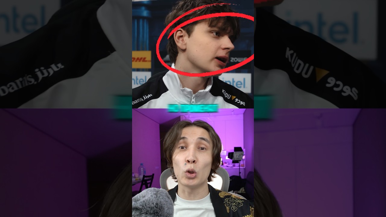 Он мог стать вторым Донком #cs2 #csgo #daredarkencs