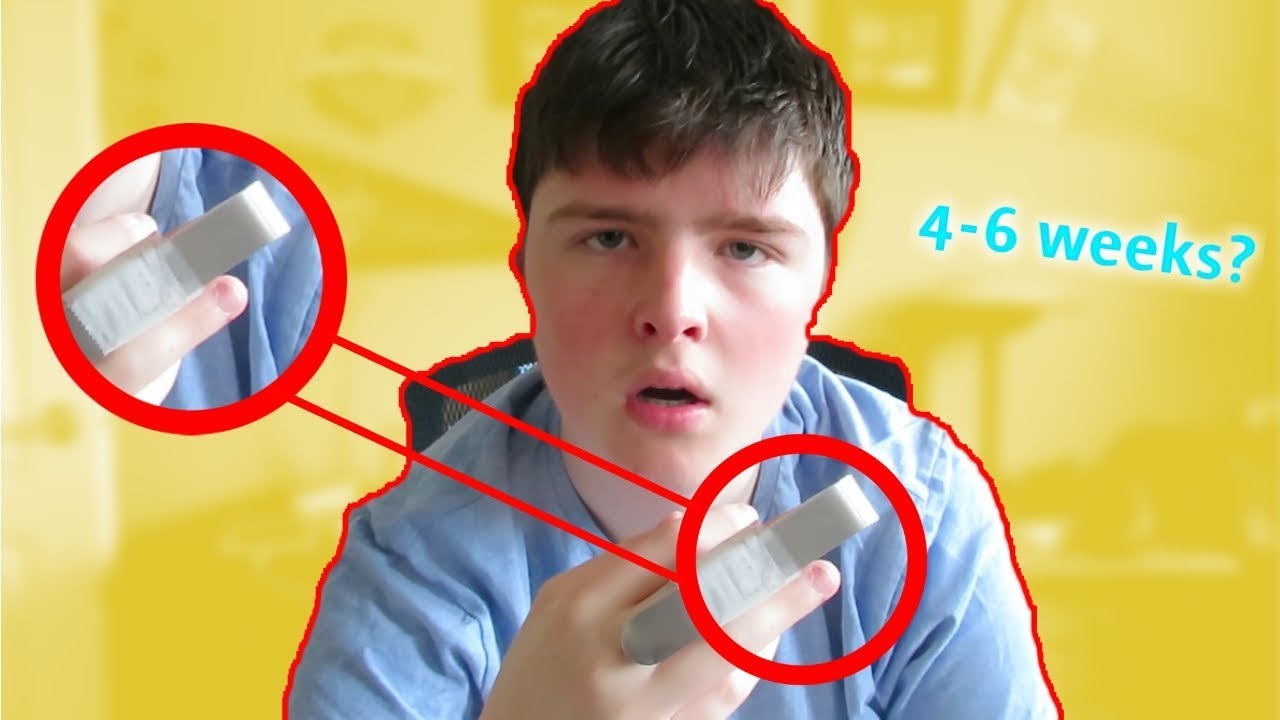 My broken finger (huge update) 😕