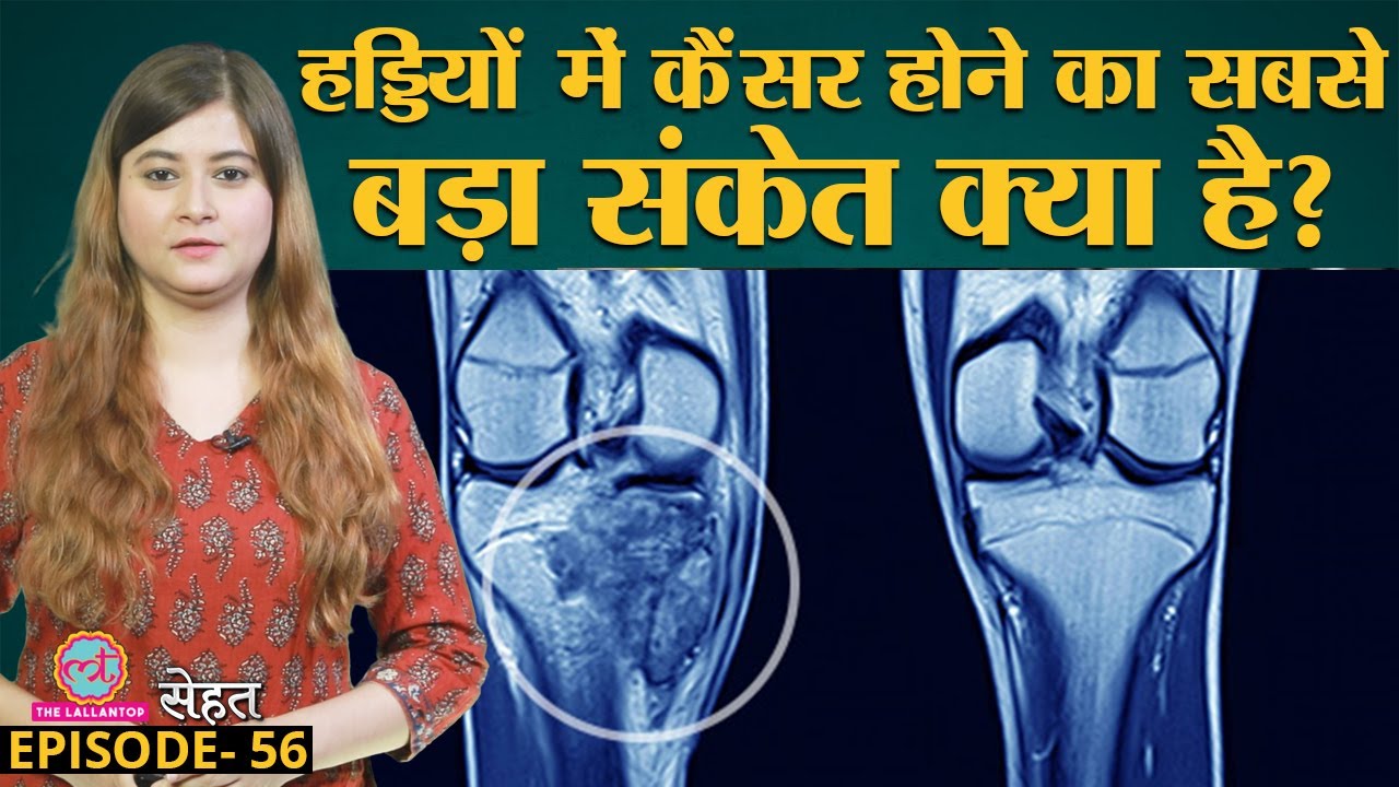 Bone Cancer से बचने का उपाय Doctors से जान लीजिए | Sehat Ep 56