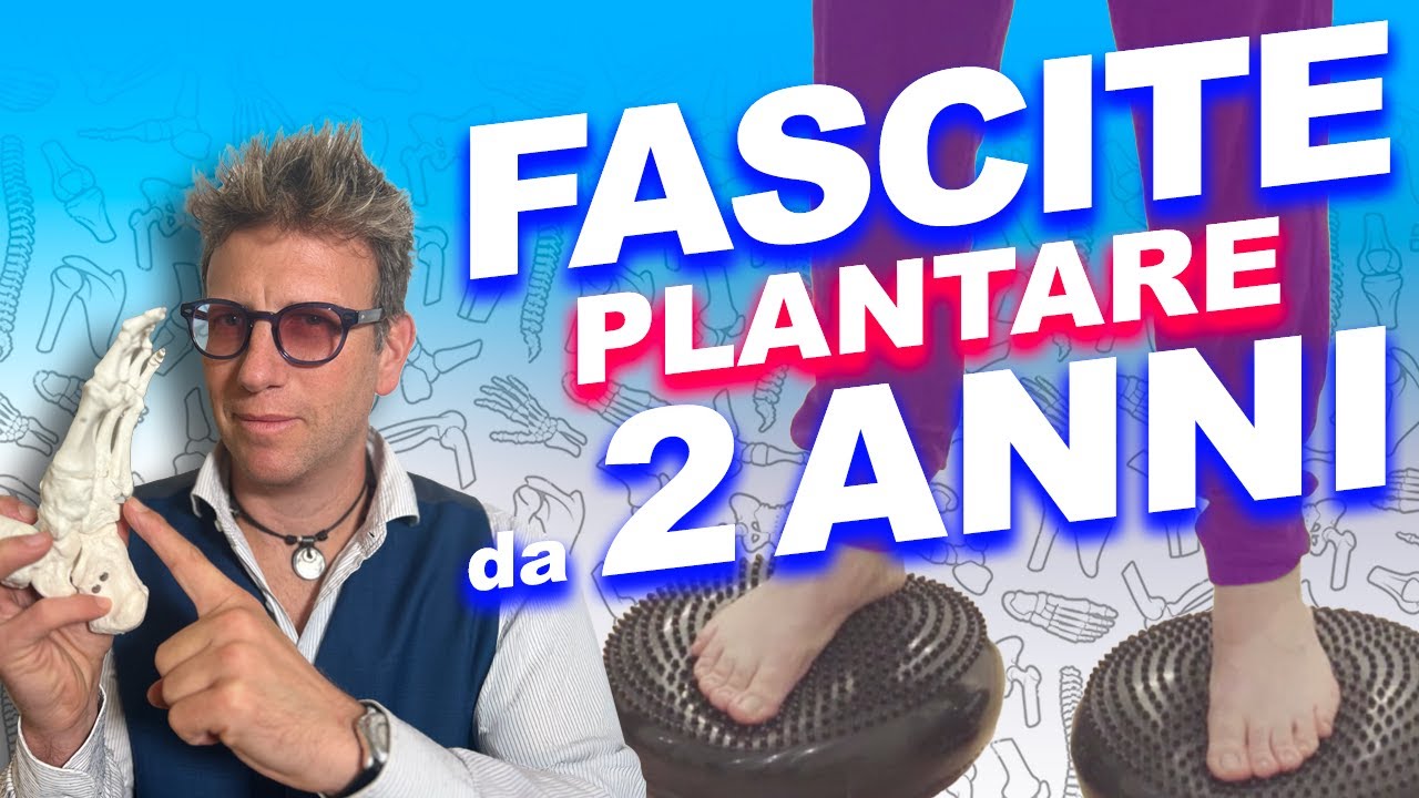DOLORE al PIEDE cronico da FASCITE PLANTARE (zoppicava da un anno)