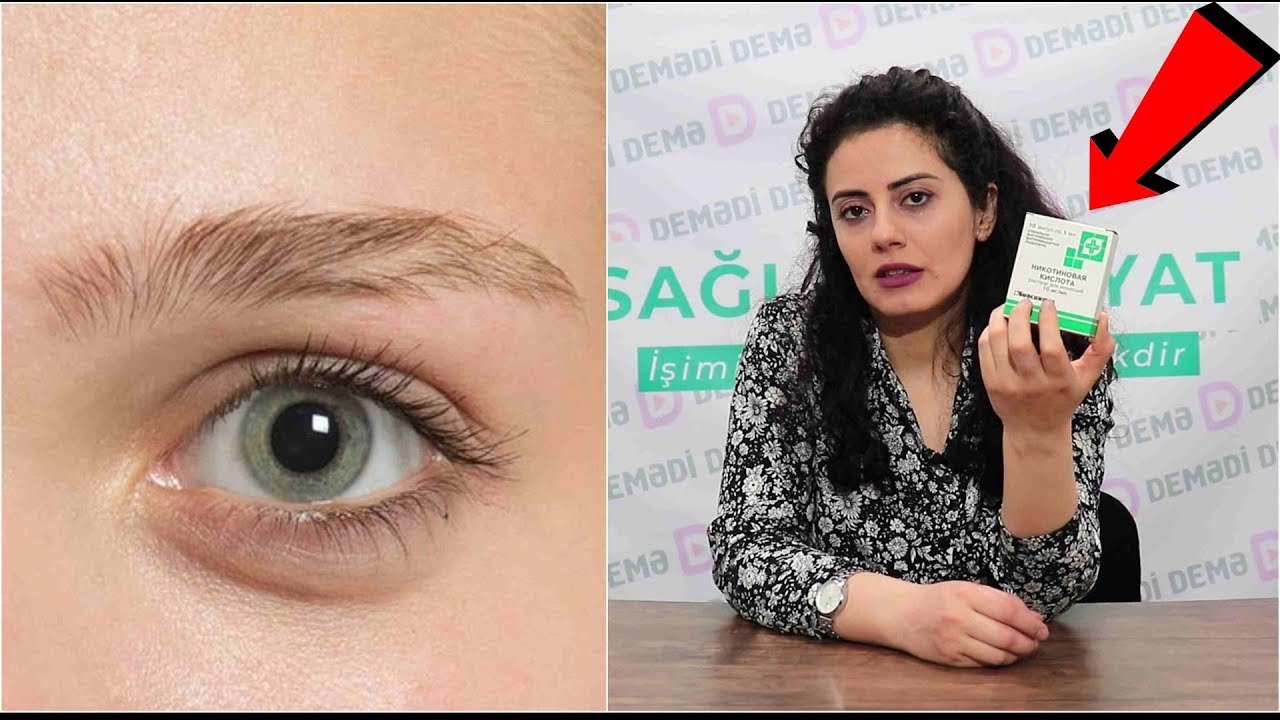 MÖCÜZƏ: Cəmi 1 manat 20 qəpiyə Tökülən Qaşları Bərpa Edin