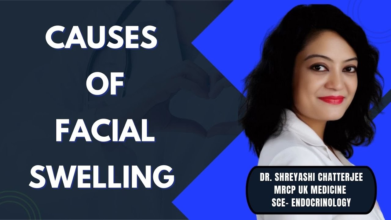 Causes of Facial Swelling | Why Your Face Becomes Puffy | Medical Explanation