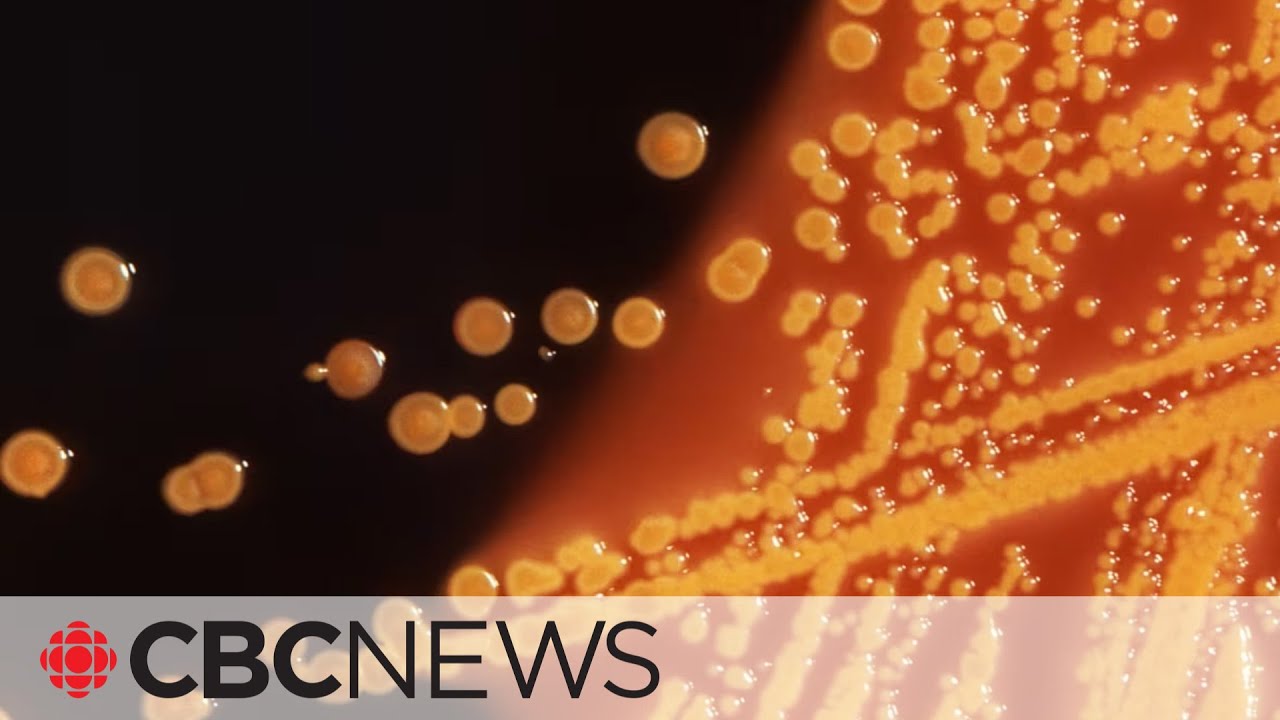 What E. coli symptoms should you be watching out for?