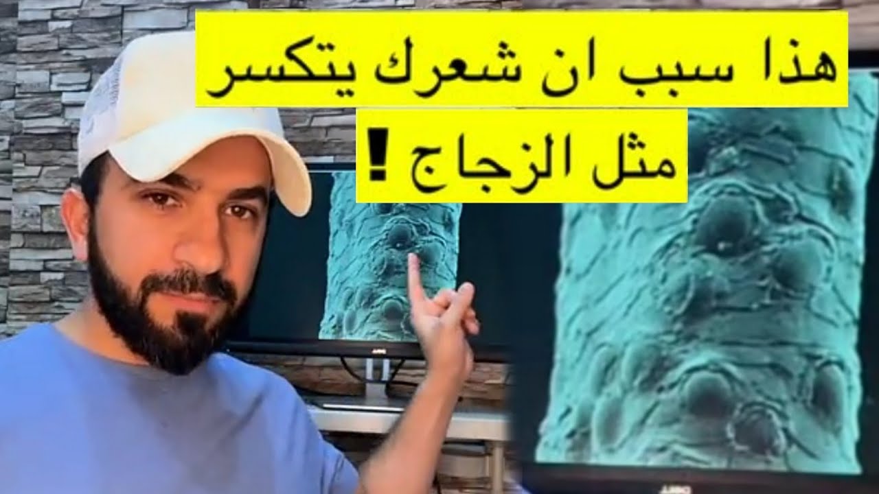 سبب تكسر الشعر وكيف يمكن علاج تكسر الشعر