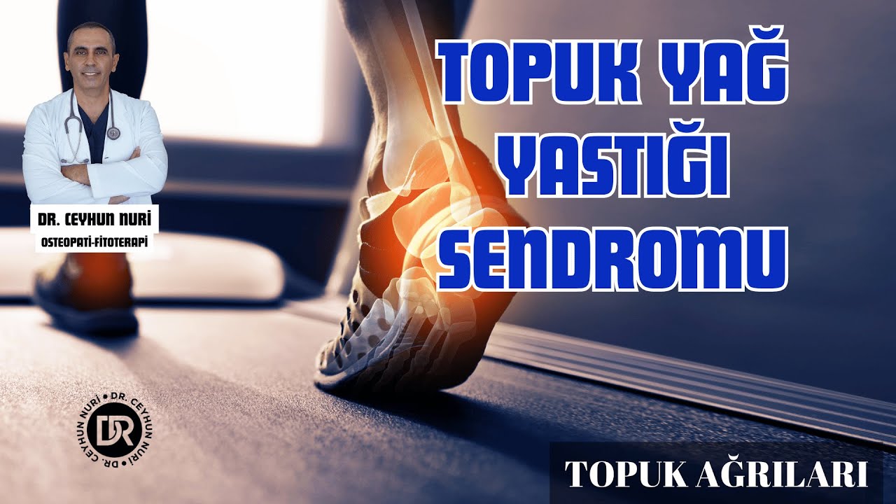Topuk Yağ Yastığı Sendromu #topuk #topukyağyastığısendromu #ankara
