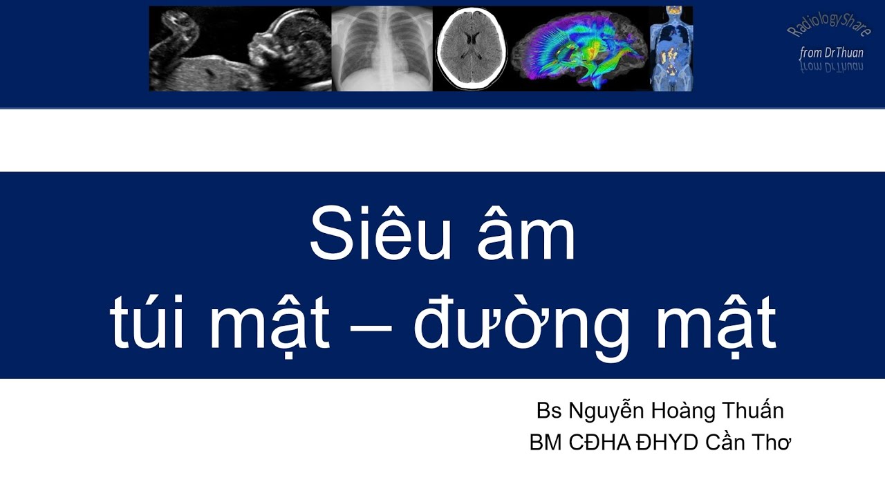 Siêu âm túi mật - đường mật 2021- Phần 2