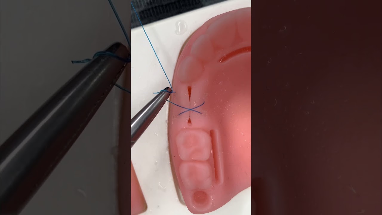 🔥T&eacute;cnica de Sutura Dental en Forma de ❌🔥