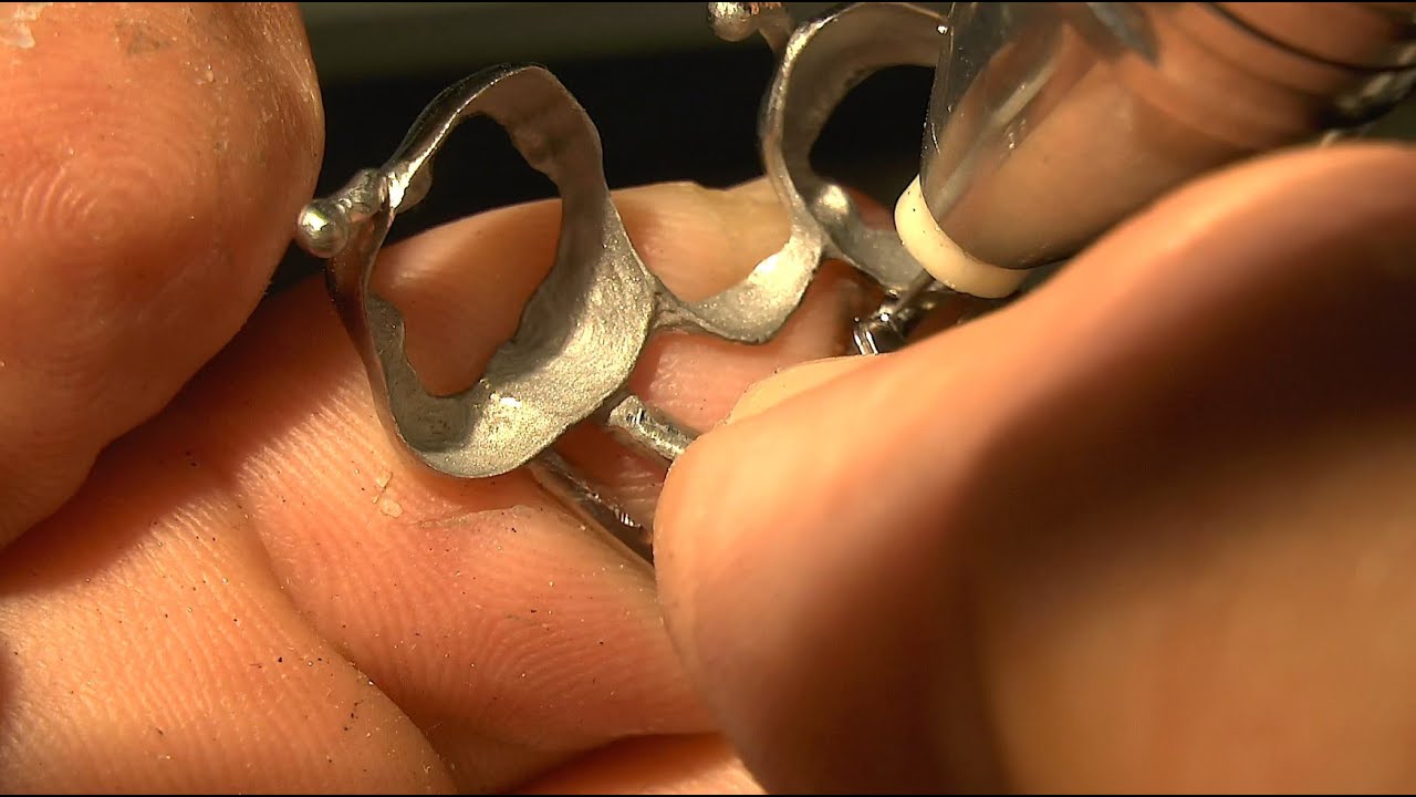 PUK dental welding - orthodontic appliance / Kieferorthop&auml;die