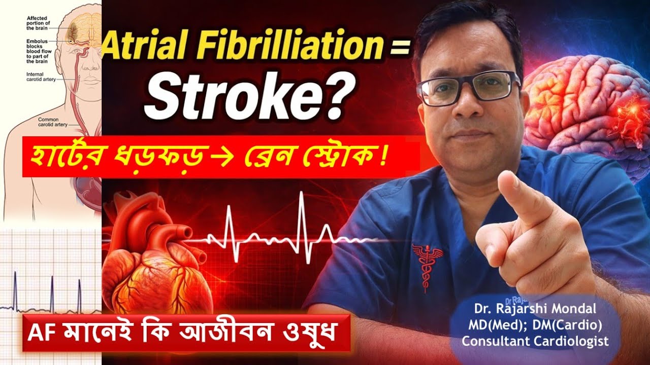 Atrial Fibrillation: অনিয়মিত হার্টবিট, স্ট্রোকের বড় কারণ I What is AF ? Explained Simply .