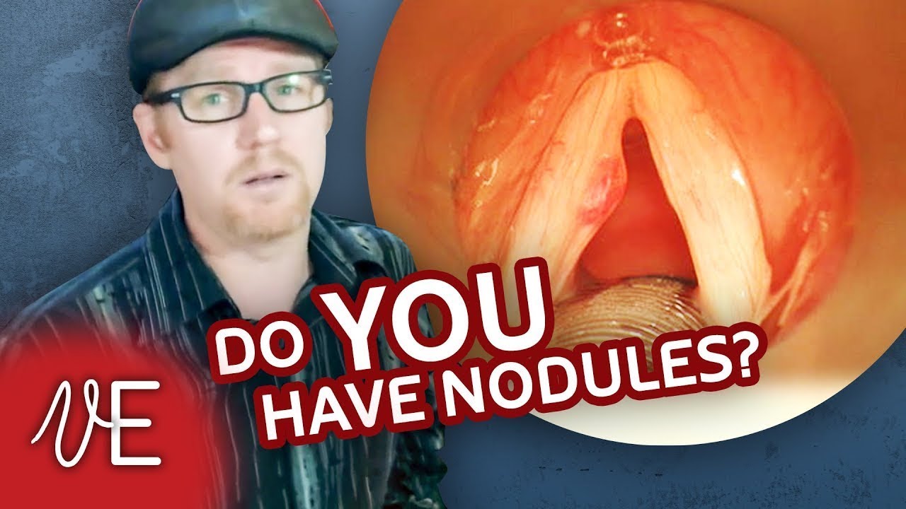 Do I Have Nodules? | Nodes on Vocal Cords | #DrDan 🎤