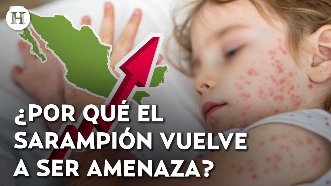 ¿Por qué una enfermedad prevenible vuelve a ser mortal? Sarampión vuelve a cobrar vidas