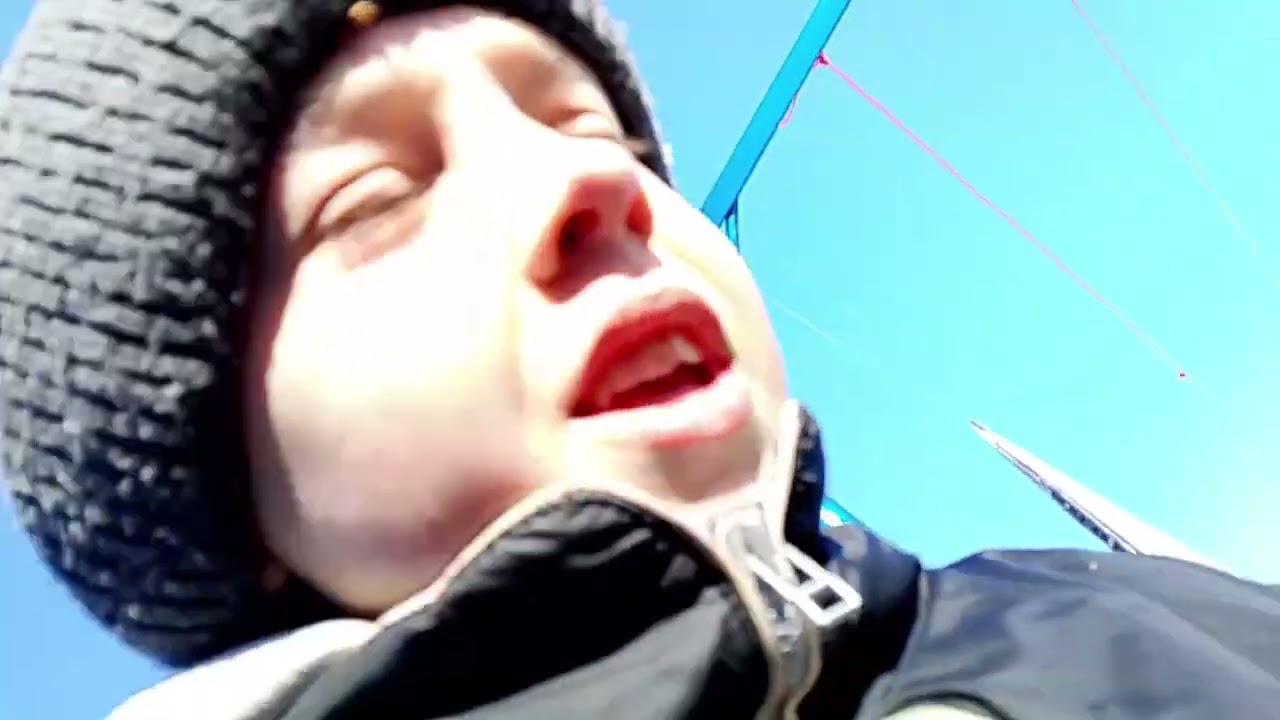 Застрелили ногу