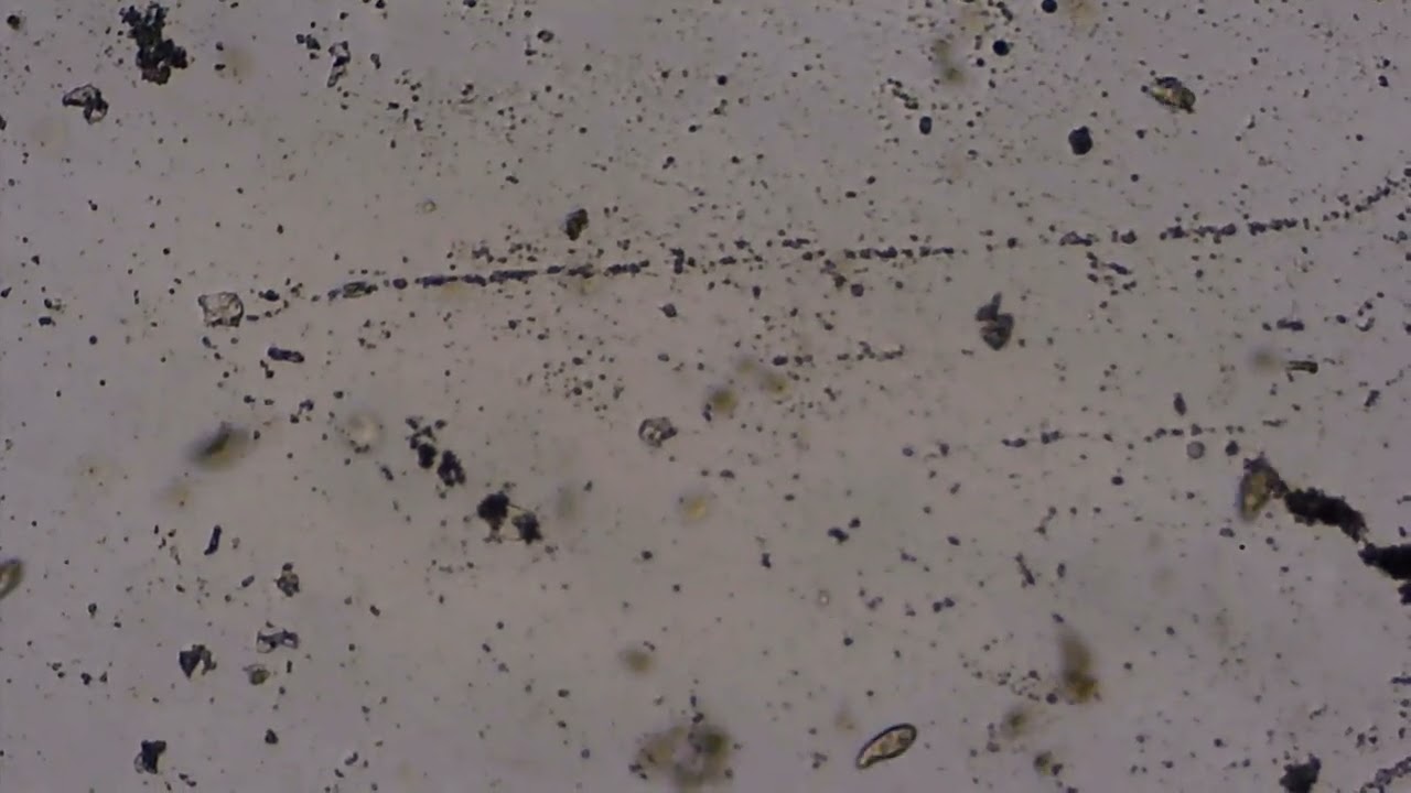 Pantofelki (Paramecium caudatum) - pr&oacute;bka wody z Czerniej&oacute;wki #1