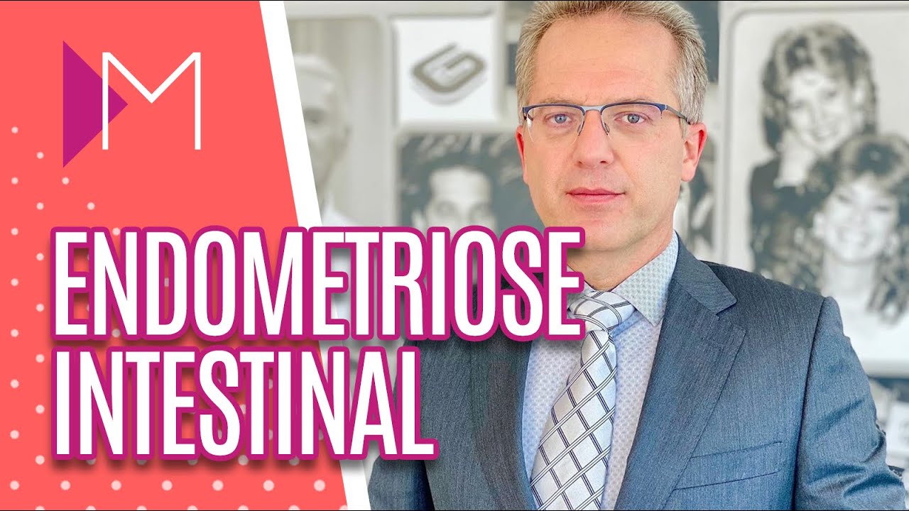 Tire suas dúvidas de ENDOMETRIOSE INTESTINAL - Mulheres (24/08/20)