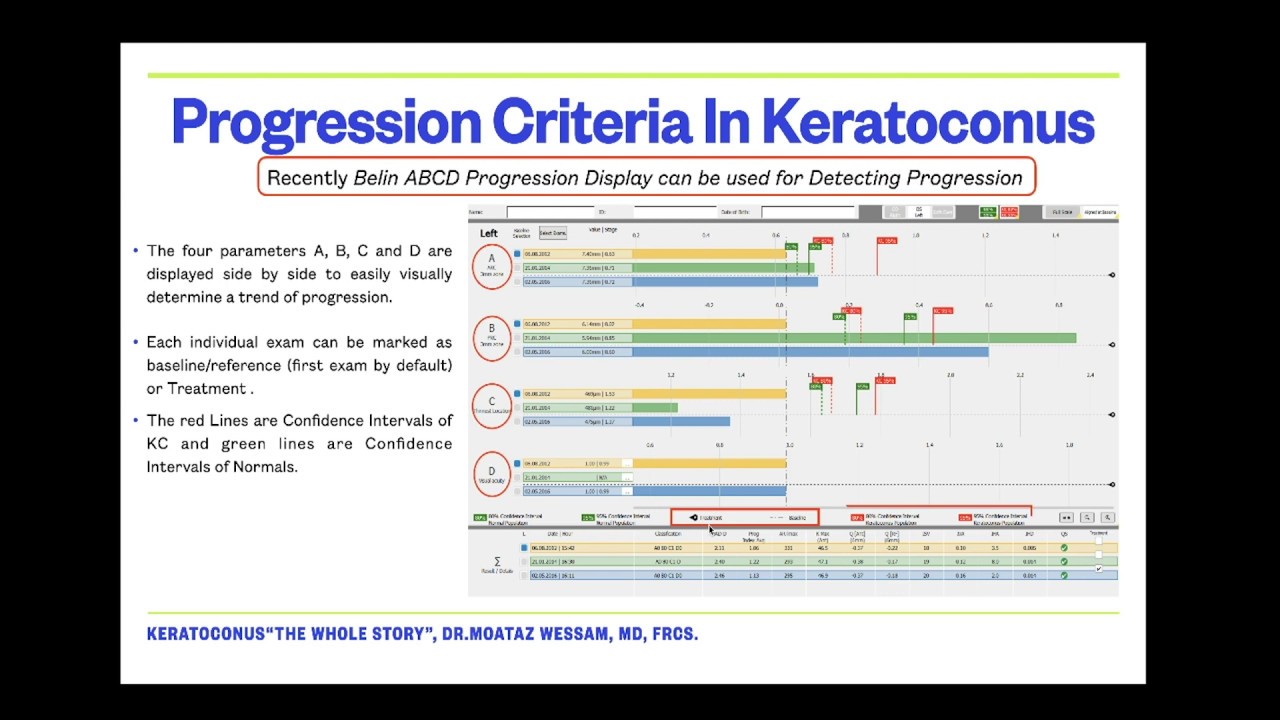 Clinical Grading and Progression Criteria in Keratoconus by Dr.Moataz Wessam