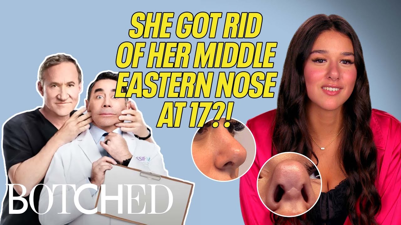 Мама Жасмин отвела её на ринопластику в 17 лет?! (До и после) | Неудачная операция | E!