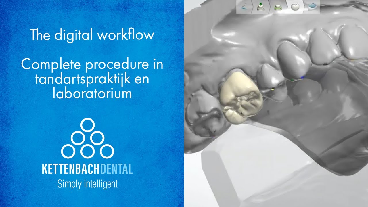 Digital Workflow compleet