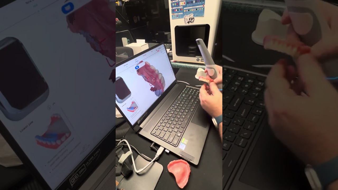 Creating duplicate denture scan with shining intraoral scanner