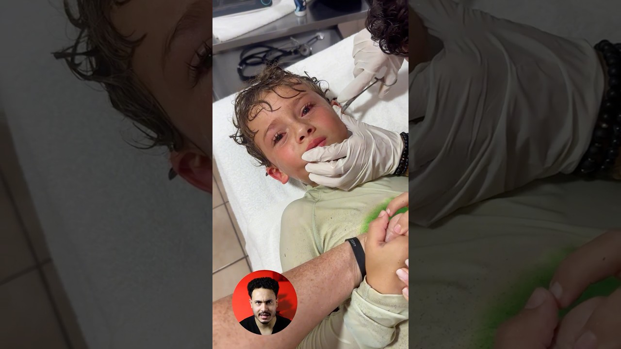 خروج كائن غريب من اذن الطفل ‼️ #دكتور_مصطفى  #اكسبلور  #viral #shorts