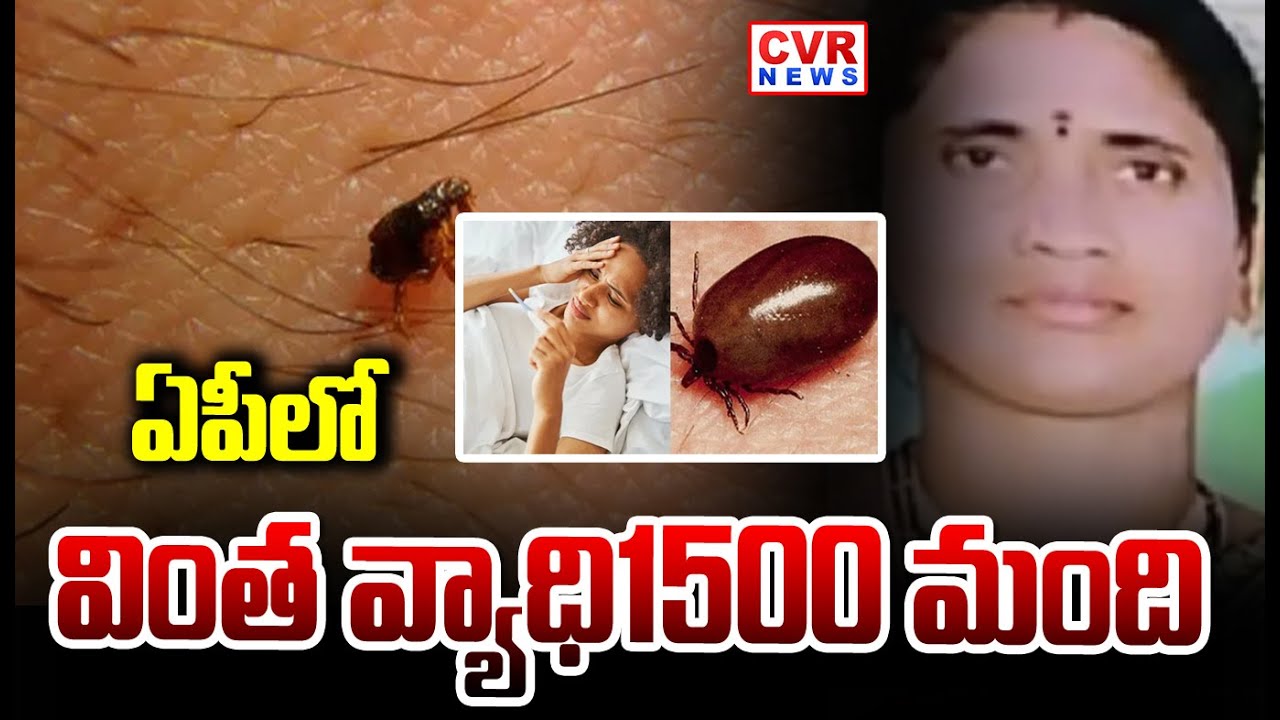 ఏపీలో స్క్రబ్ టైఫస్ వ్యాధి పై ప్రభుత్వం అప్రమత్తం | Scrub Typhus Cases In AP | CVR NEWS