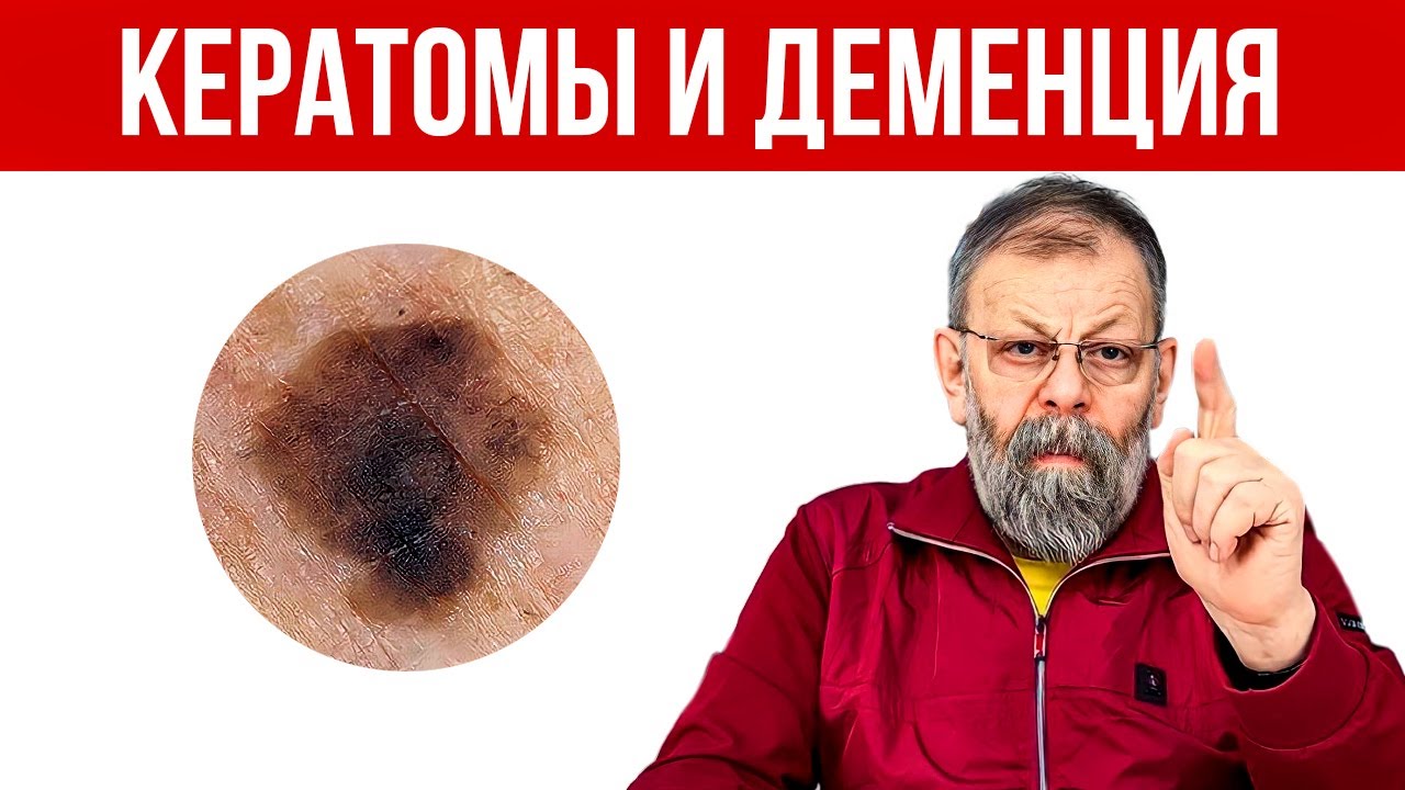 Деменция — объясню и покажу как быстро вылечить.