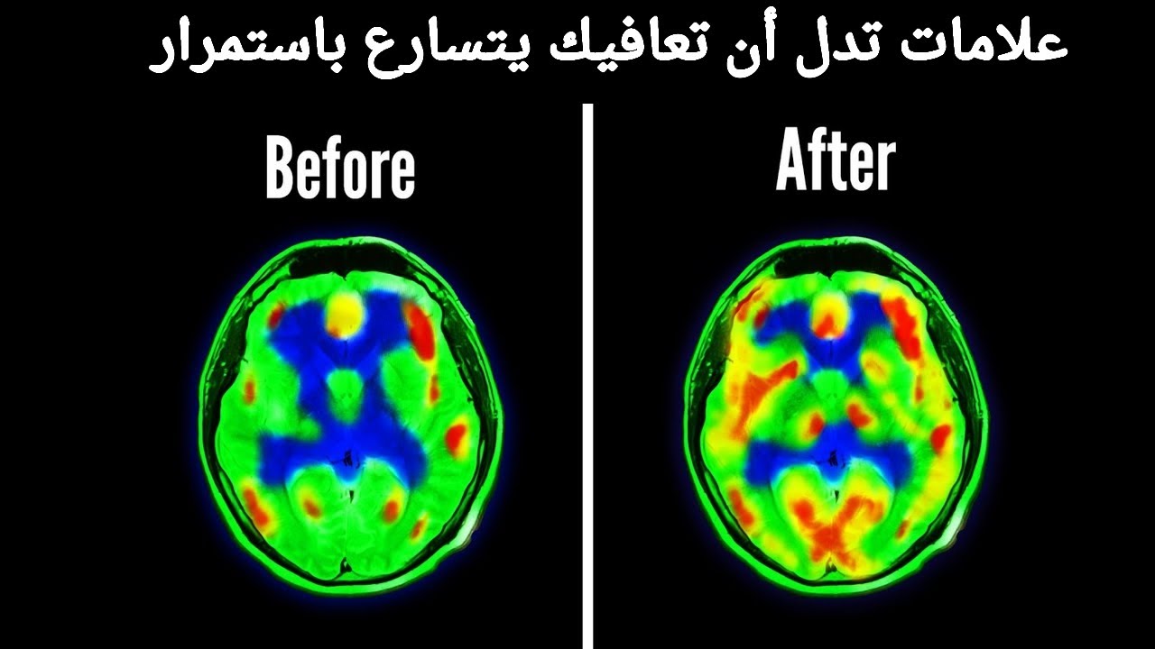 علامات خفية تثبت أن التعافي ينجح معك!