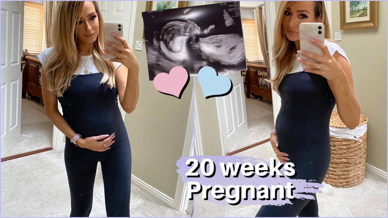 20 WEEK PREGNANCY UPDATE, MY SYMPTOMS & BABY BUMP