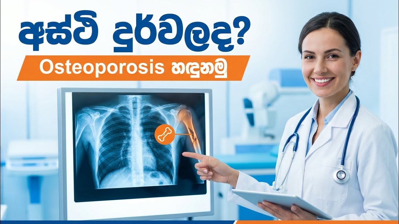 අස්ථි දුර්වලද? Osteoporosis රෝග ලක්ෂණ 10ක් හා විසඳුම් | Doctor Advice Sinhala 