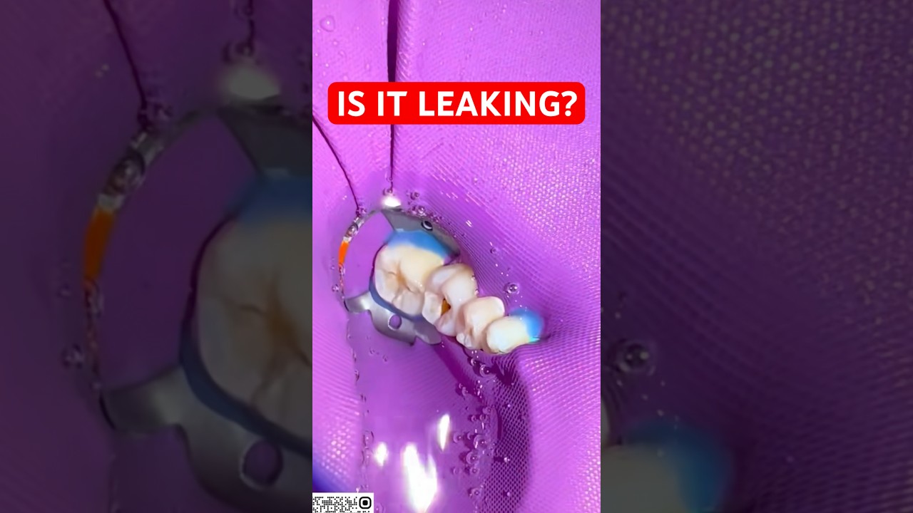 If This Leaks, The Procedure Fails