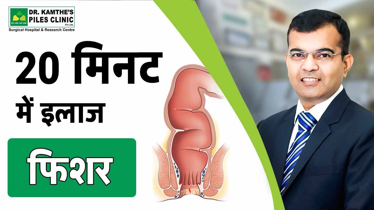 फिशर का इलाज 20 Minutes में कैसे होता है | Fissure Operation 20 Minutes Dr Kamthe Piles Clinic ||
