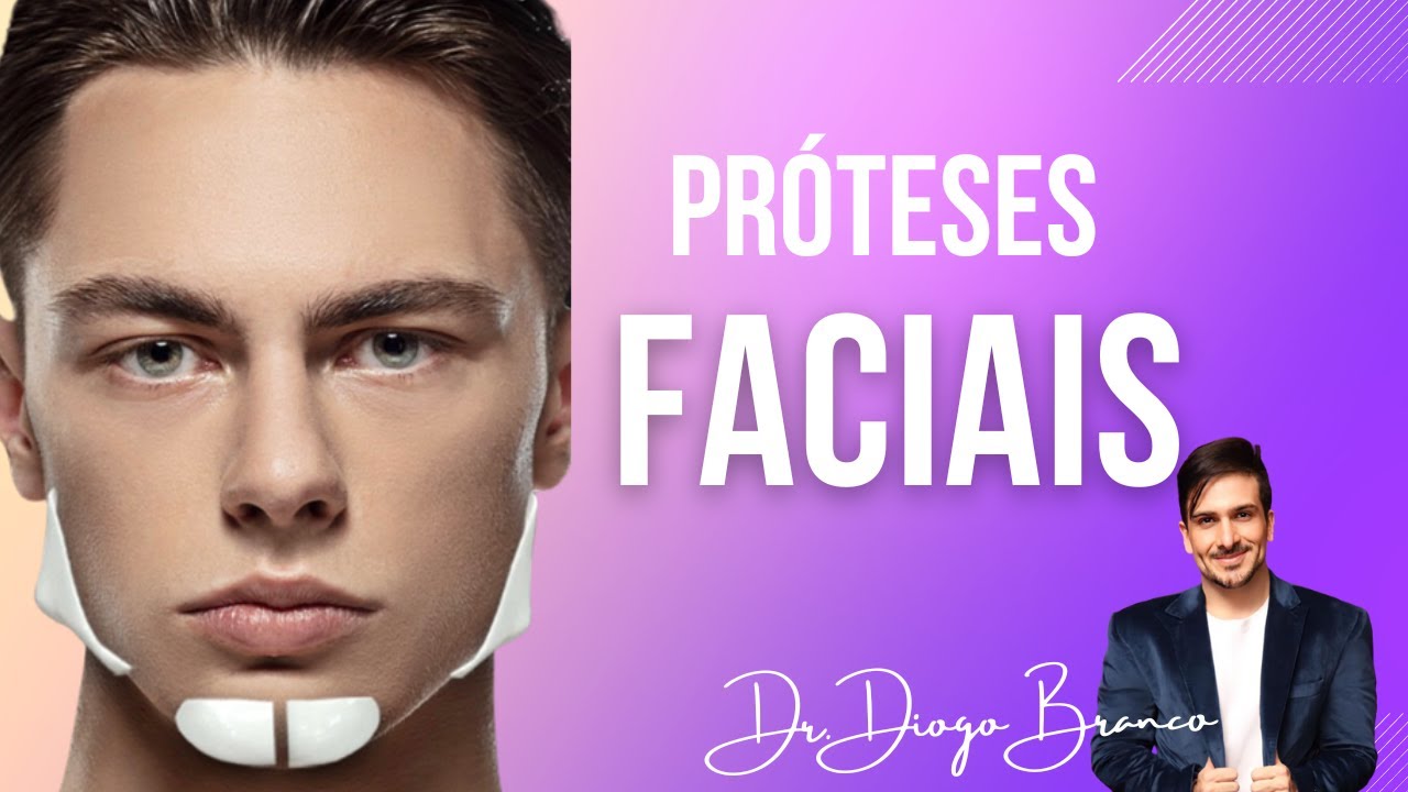 Próteses Faciais ou Implantes Faciais - O que são? Mentoplastia - Dr Diogo Branco #protesesfaciais