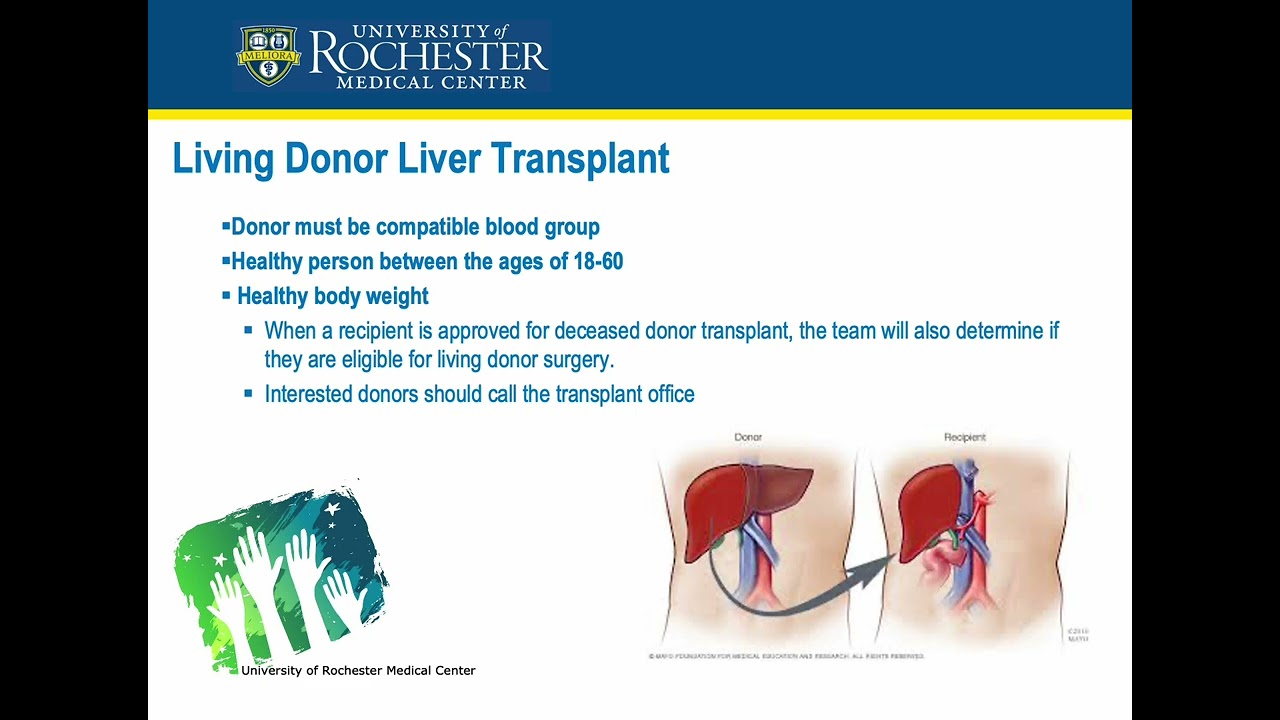 UR Medicine Pre-Liver Transplant Class | Transplant