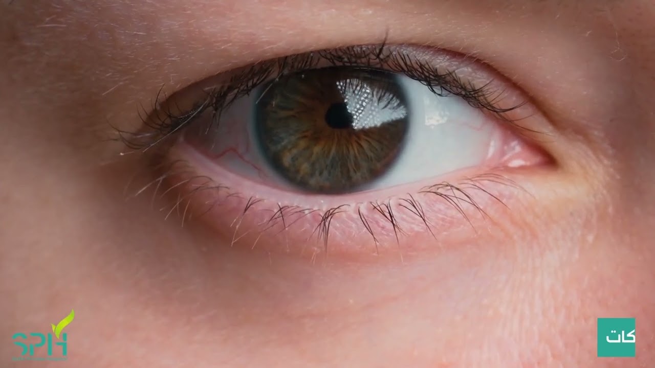 باسێک دەربارەی هەستیاری چاو